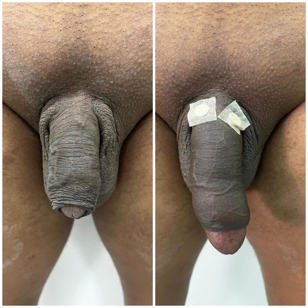 andrologista em santos