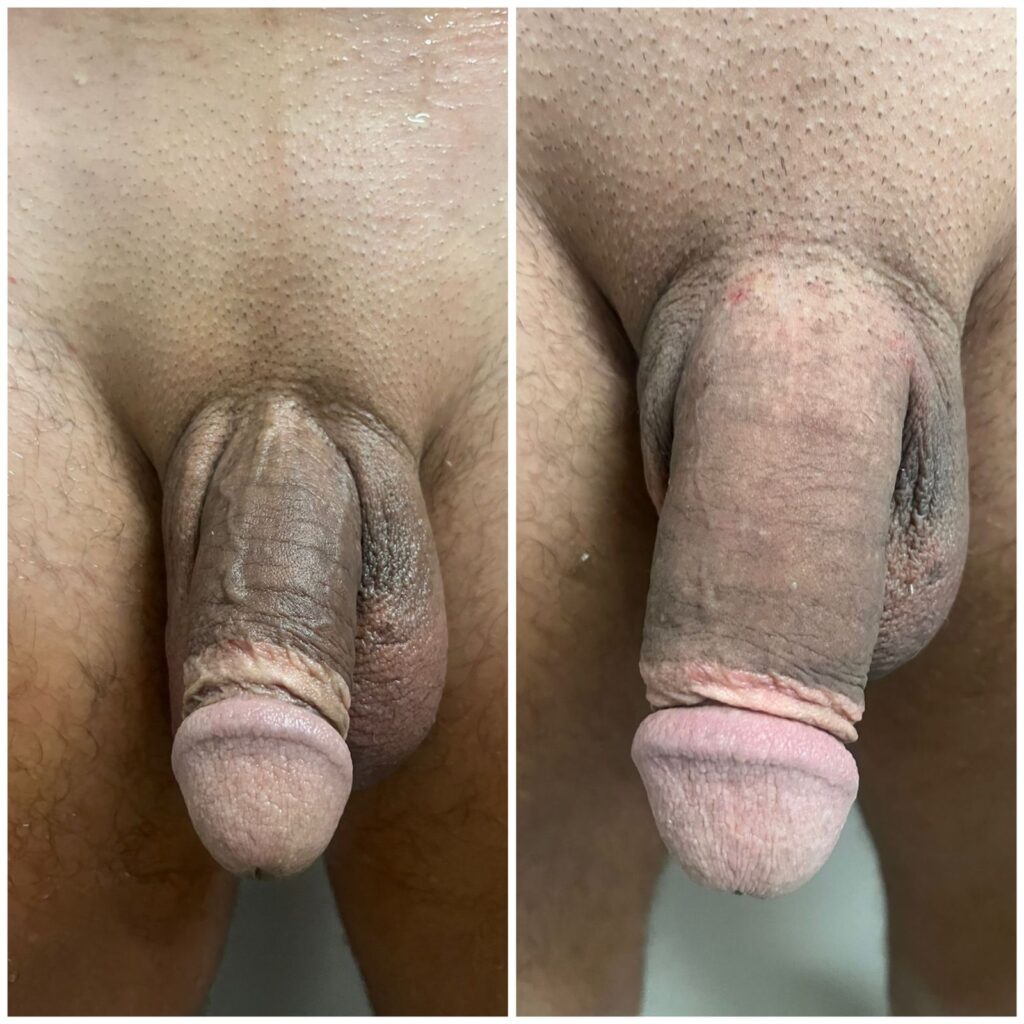 andrologista em santos